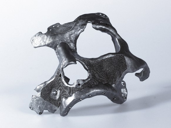 Pedazo de cráneo de titanio. Diseño Generativo.